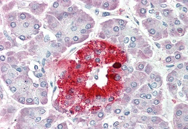 proSAAS Antibody