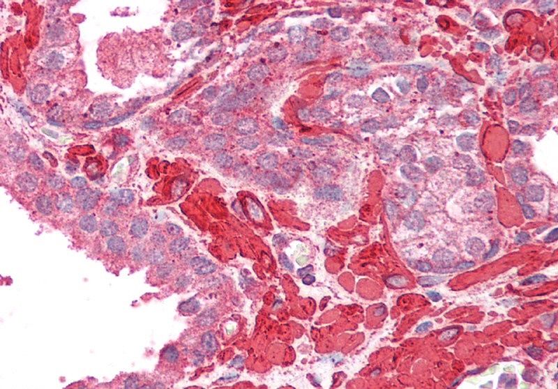 tropomyosin 4/TPM4 Antibody