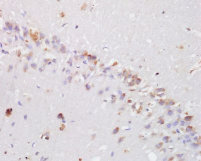 Hydroxyproline Rabbit Polyclonal Antibody (Biotin)