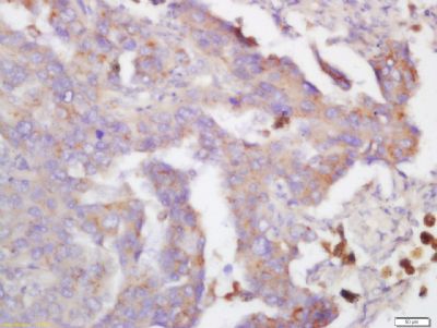 Hydroxyproline Rabbit Polyclonal Antibody (Biotin)