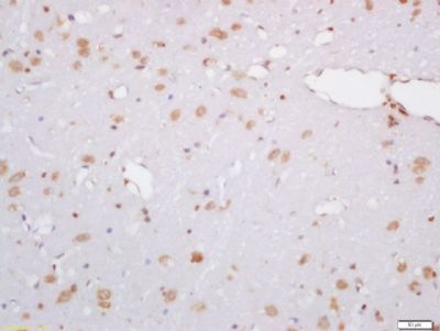 Hydroxyproline Rabbit Polyclonal Antibody (Biotin)