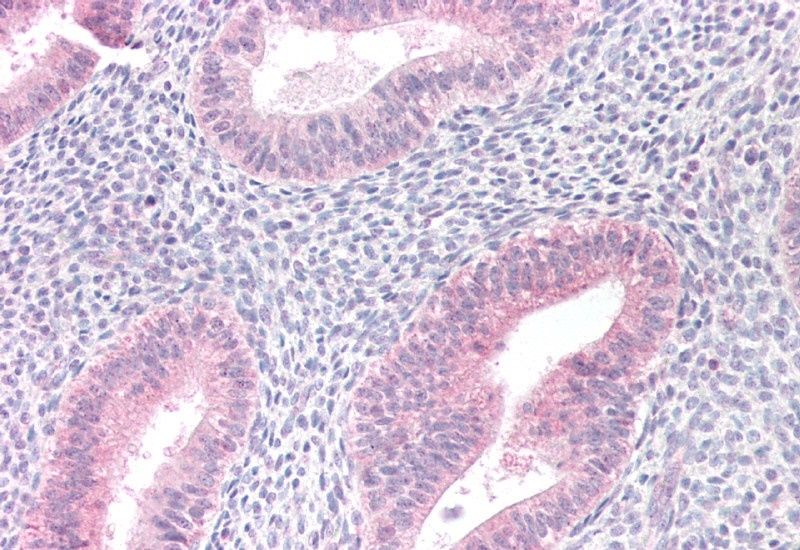 MTM1 Antibody