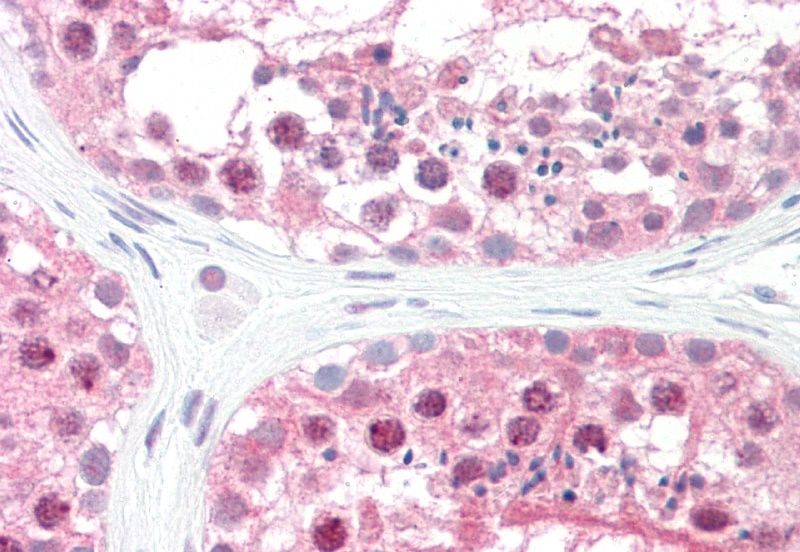 GPS1/COPS1 Antibody