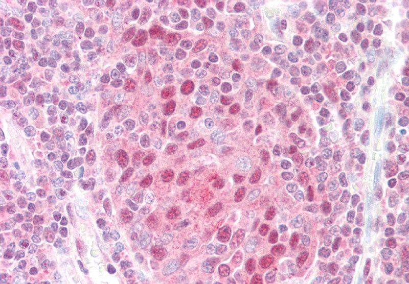GPS1/COPS1 Antibody