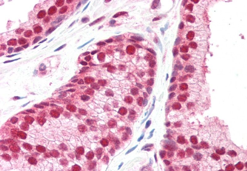 GPS1/COPS1 Antibody