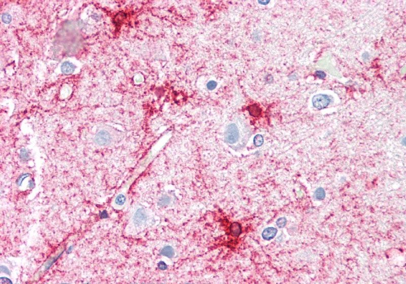 VPS45 (C Terminus) Antibody