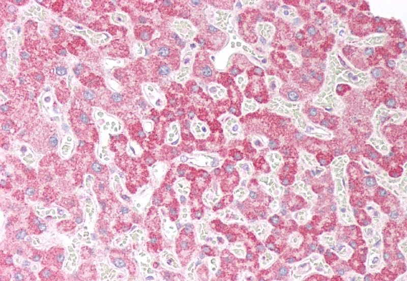 ORP5 (OBPH1) Antibody