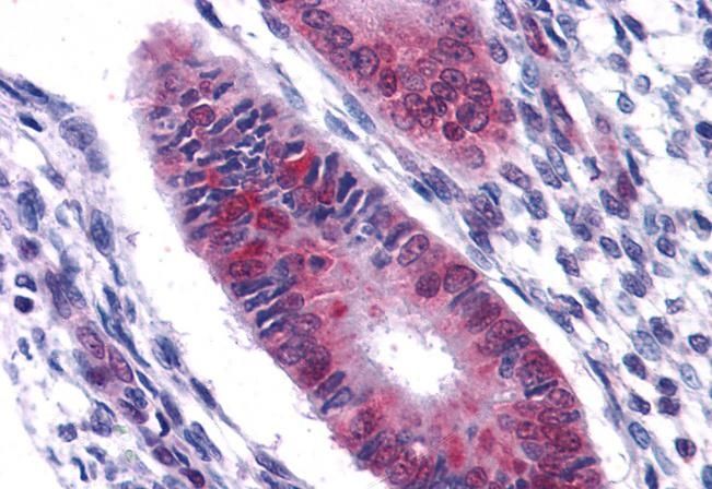 DDX5/p68 RNA helicase Antibody