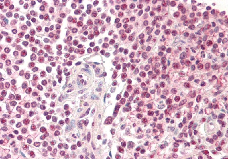 Pirin Antibody
