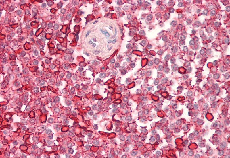 Wiskott-Aldrich Syndrome/WASP Antibody