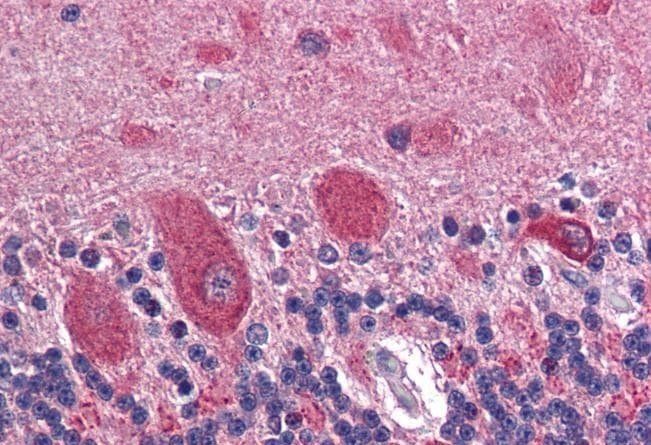 GAD2/GAD65 Antibody