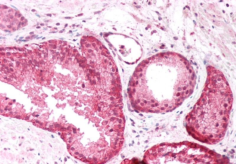 PICK1 Antibody