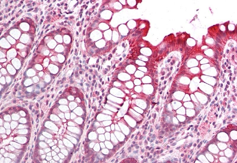 PICK1 Antibody