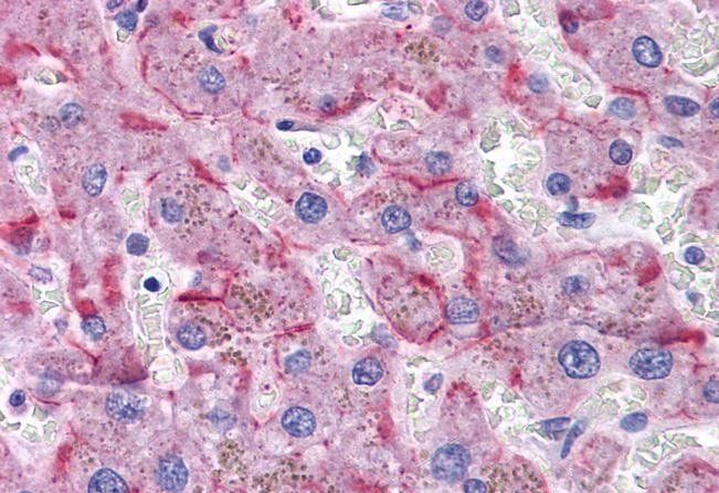 SORBS1/ponsin (internal region) Antibody