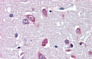 BDNF Antibody