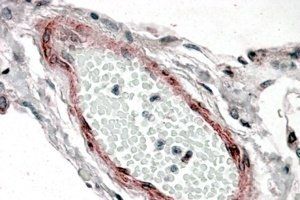 CRP2/CSRP2 Antibody