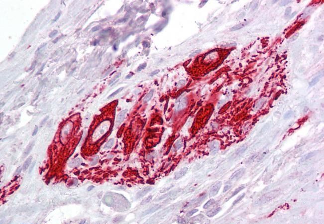 ITM2B Antibody