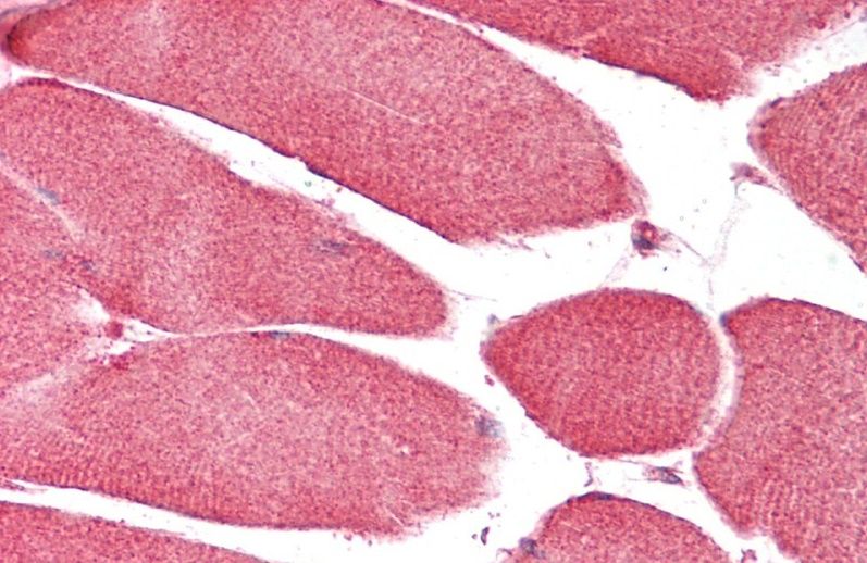 CHCHD3 Antibody