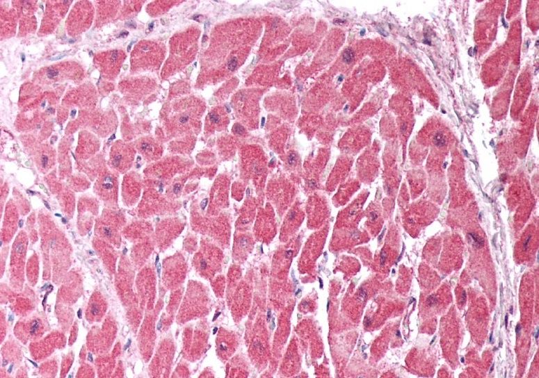 CHCHD3 Antibody