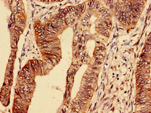 TFRC Antibody