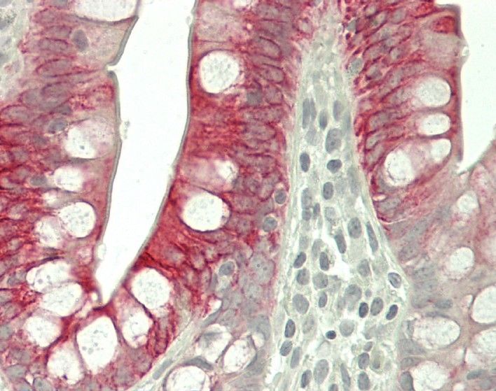 Mouse Cytokeratin 20 Antibody