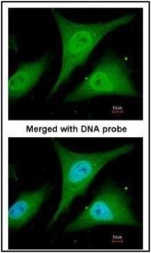 IKB alpha Rabbit Polyclonal Antibody