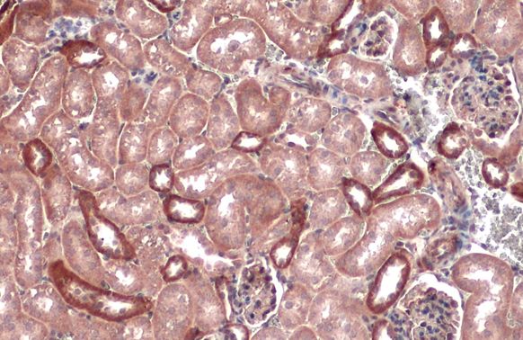 IKB alpha Rabbit Polyclonal Antibody