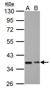 IKB alpha Rabbit Polyclonal Antibody