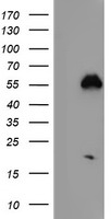 NFKBIZ Antibody