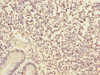 IKBIP Antibody