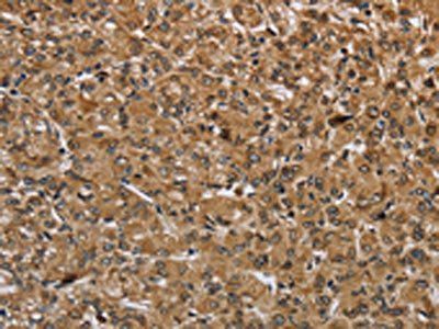 IKBIP Antibody