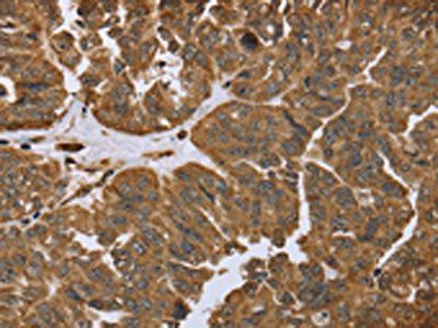IKBIP Antibody