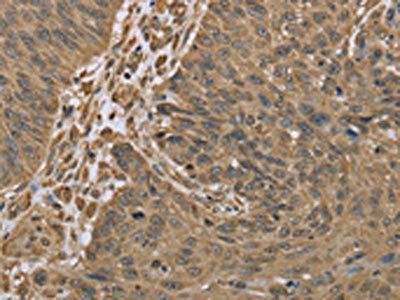 IKBIP Antibody