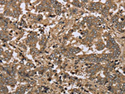 IKBIP Antibody