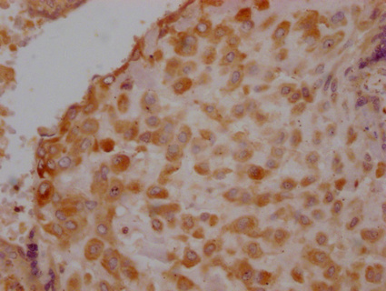 IKBIP Antibody