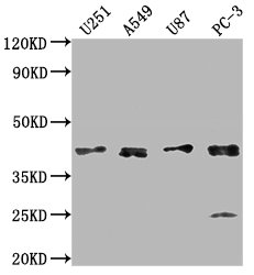 IKBIP Antibody
