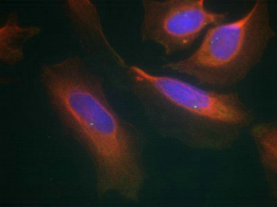 IKBKB Antibody