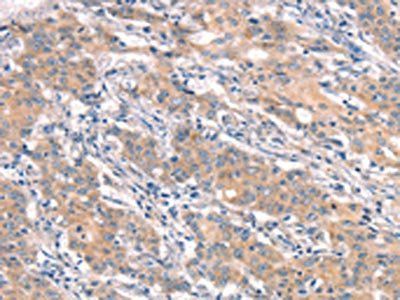 IKBKB Antibody