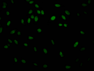IKBKB Antibody