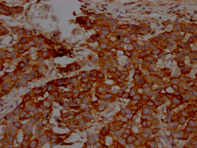 IKBKB Antibody