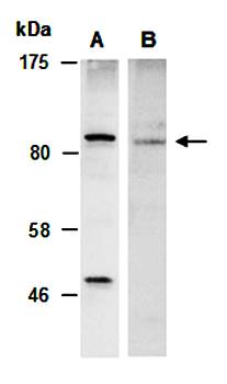 IKBKB (C) Antibody, Rabbit Polyclonal