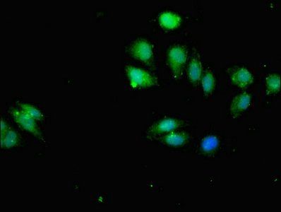 IKBKB Antibody