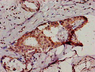 IKBKB Antibody