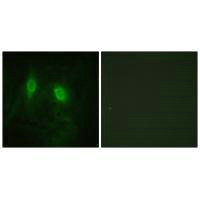 IKBKG Antibody