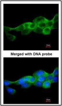 IKK beta Rabbit Polyclonal Antibody