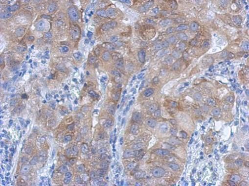 IKK beta Rabbit Polyclonal Antibody
