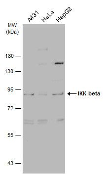 IKK beta Rabbit Polyclonal Antibody