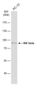 IKK beta Rabbit Polyclonal Antibody