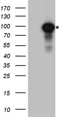 IKK beta Antibody