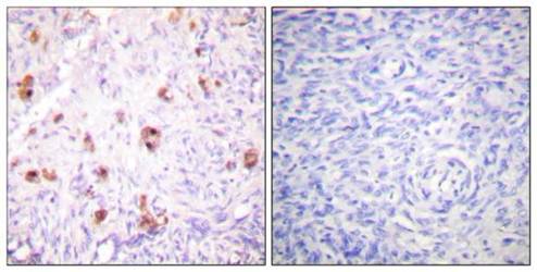 IKK-γ (Phospho-Ser31) Antibody